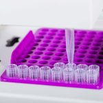 全自動生殖道分泌物分析儀 AutowoMO W500